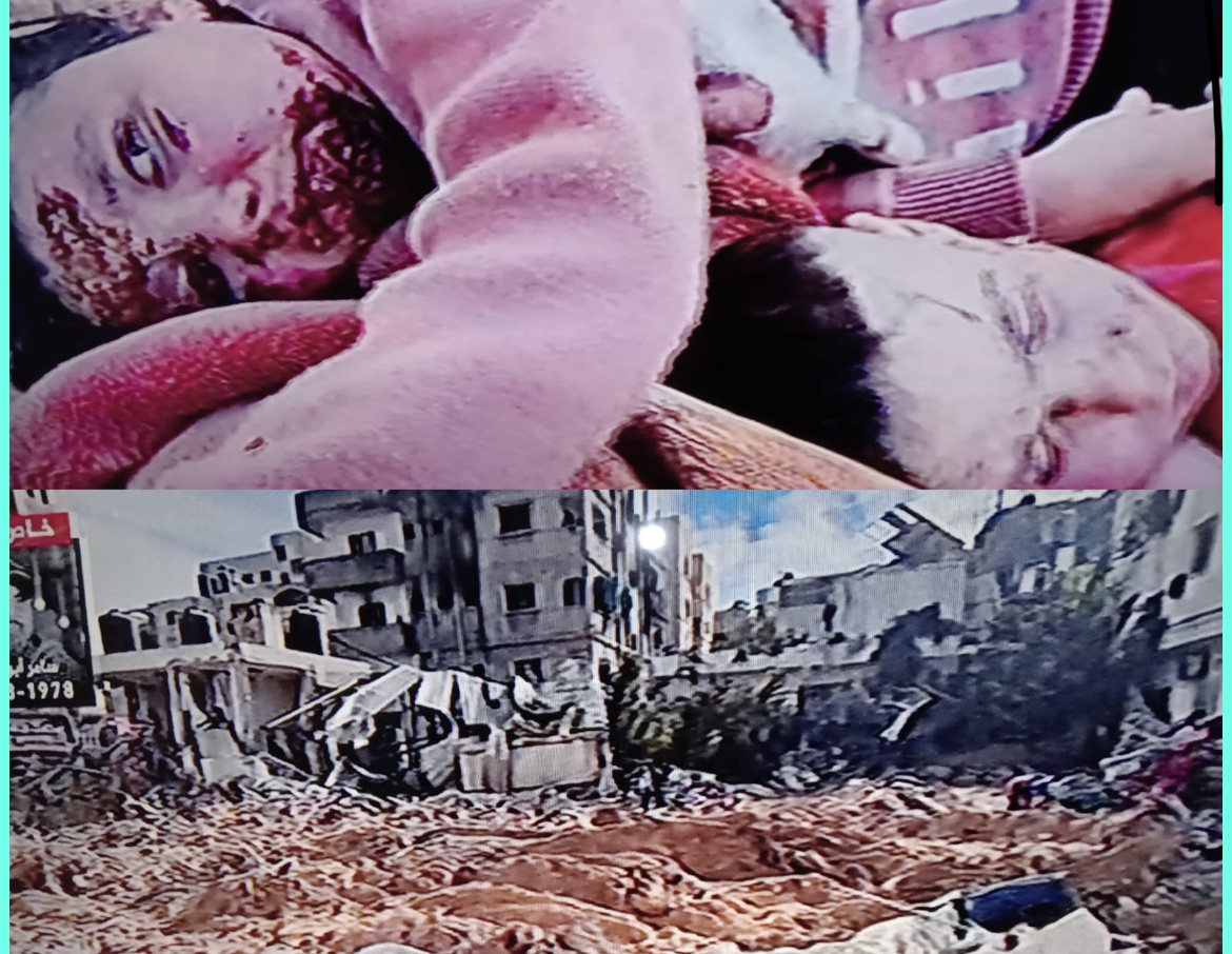 أين العالم المجرم: مجزرة رهيبة في مستشفى كمال عدوان؟!