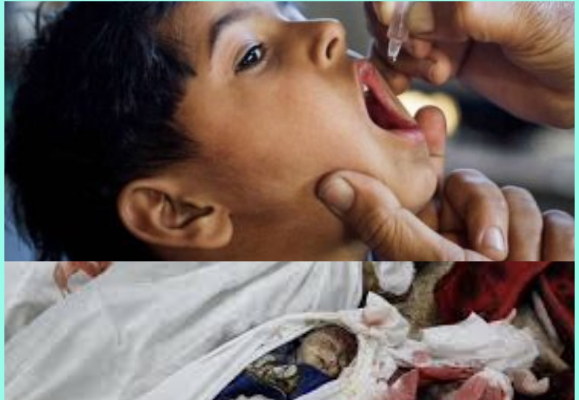 من يسعون لمكافحة شلل الأطفال في قطاع غزة يتفرجون على قتلهم!