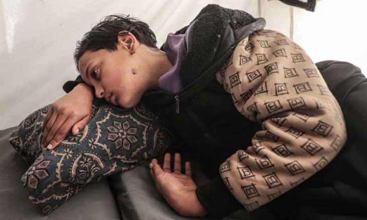 الطفل صهيب في غزة.. خرج لجلب الطعام فعاد فاقداً الكلام- (صور)