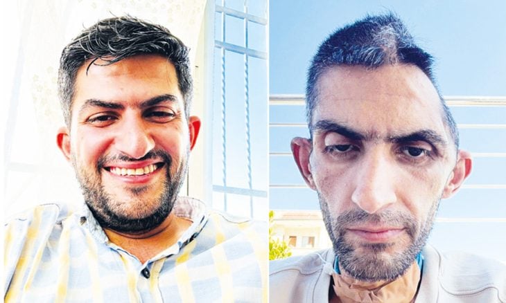 الصحافي الفلسطيني مجاهد بني مفلح… عاد من الموت مرتين